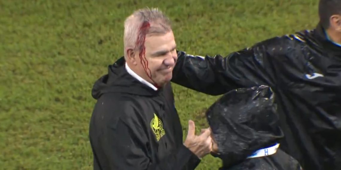 Javier Aguirre es herido por aficionados con lata y CONCACAF sanciona a Selección de Honduras