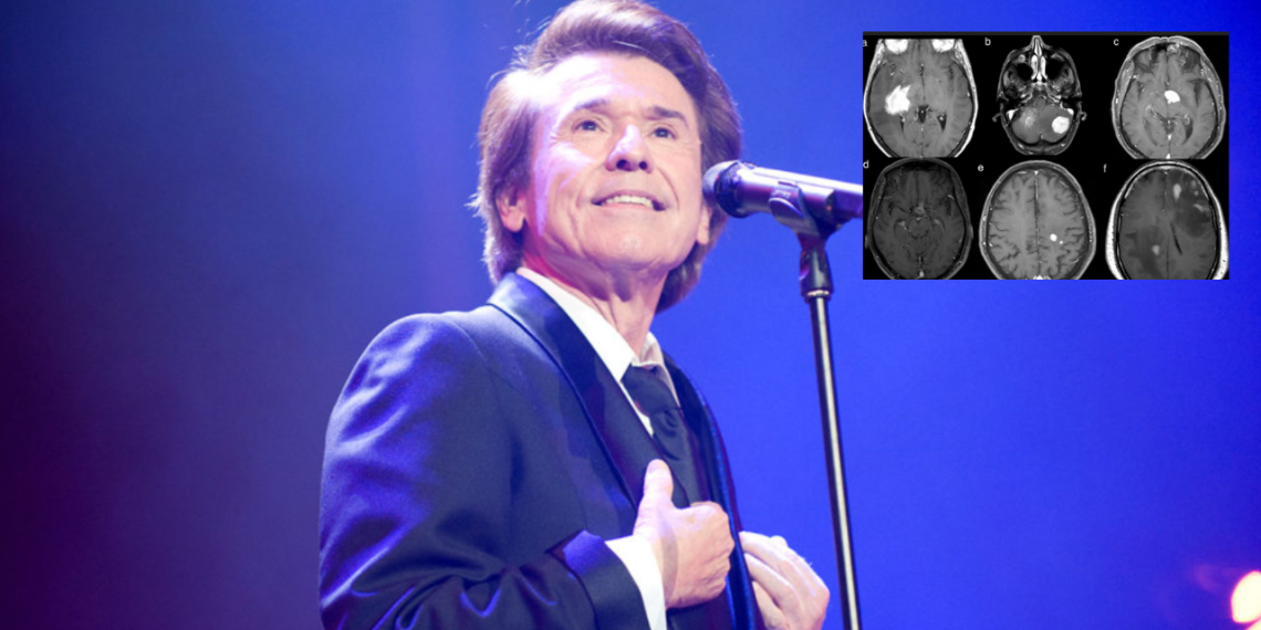 ¿Qué es el linfoma cerebral que padece Raphael?