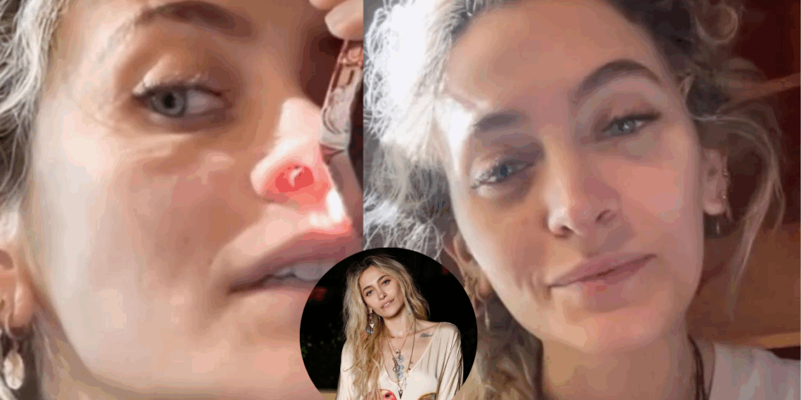 Paris Jackson muestra en video las consecuencias de su adicción: un tabique nasal perforado