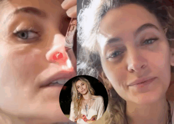 Paris Jackson muestra en video las consecuencias de su adicción: un tabique nasal perforado