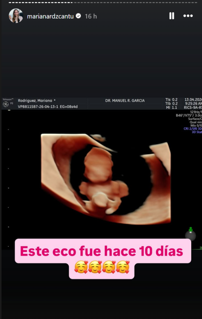 ecografía real de Mariana