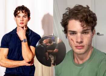 ¿Quién es Clavicular, el influencer que sufrió presunta sobredosis durante transmisión en vivo?