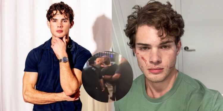 ¿Quién es Clavicular, el influencer que sufrió presunta sobredosis durante transmisión en vivo?