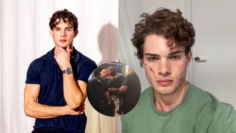 ¿Quién es Clavicular, el influencer que sufrió presunta sobredosis durante transmisión en vivo?