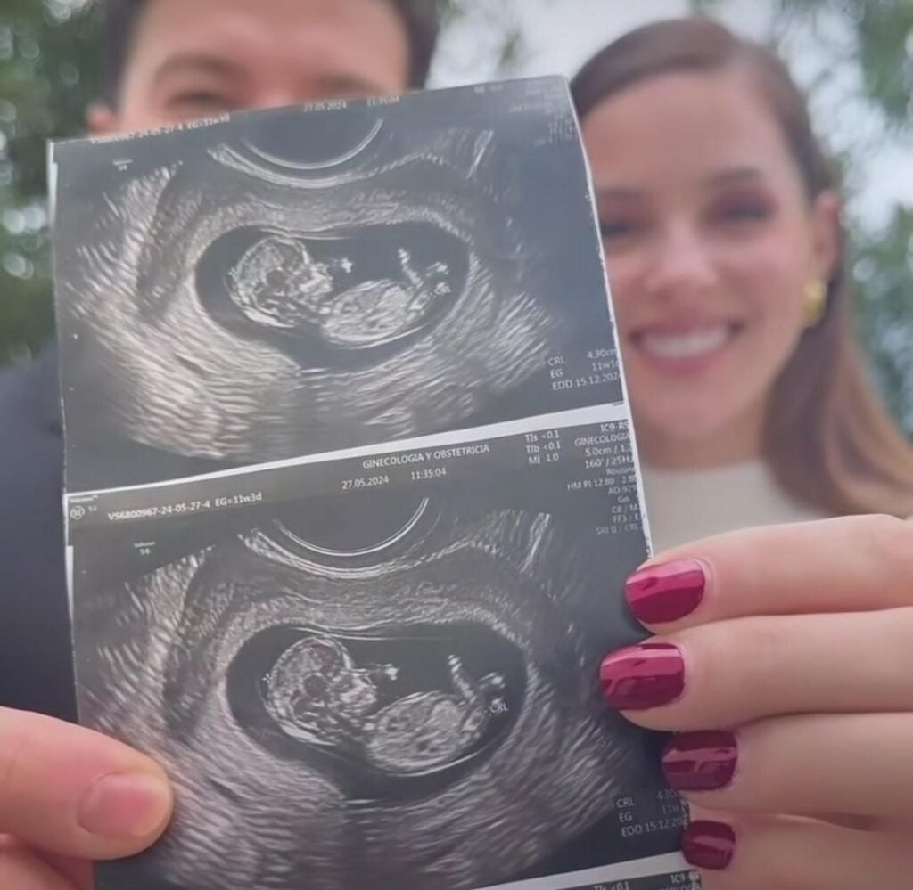 La ecografía con IA