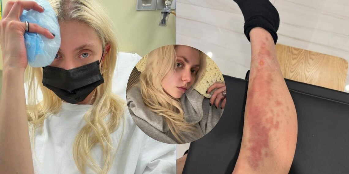 Taylor Momsen reingresa al hospital por picadura de araña.