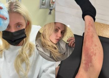 Taylor Momsen reingresa al hospital por picadura de araña.