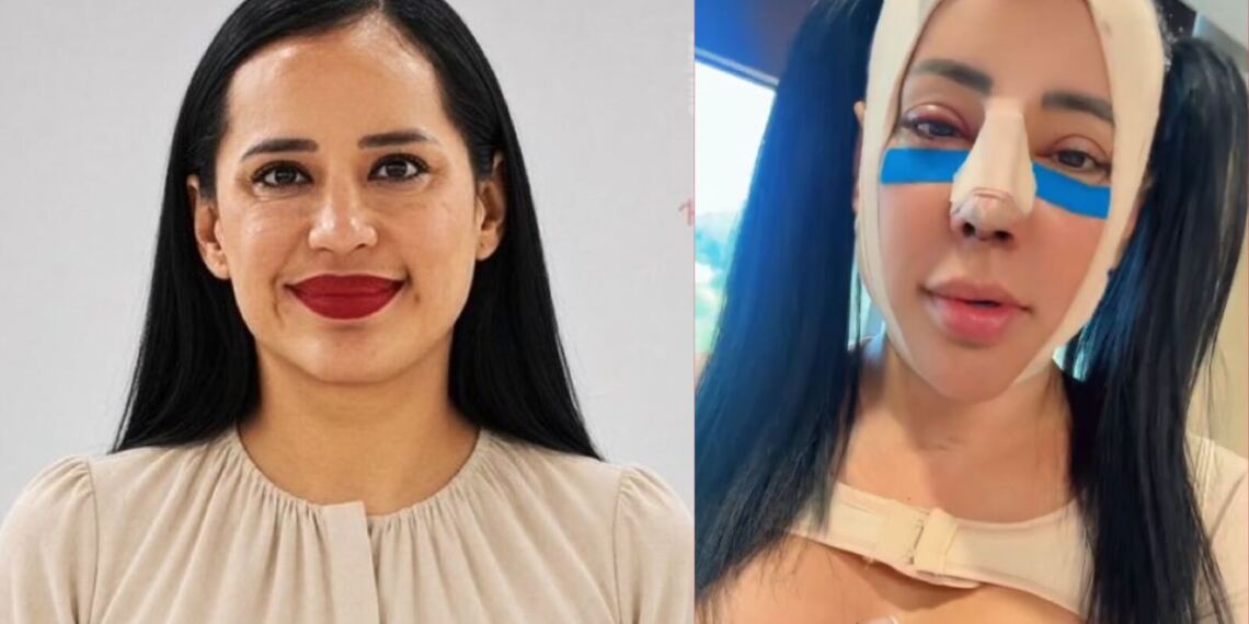 Sandra Cuevas sorprende con su nueva apariencia tras cirugía; redes sociales reaccionan con críticas y memes