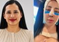 Sandra Cuevas sorprende con su nueva apariencia tras cirugía; redes sociales reaccionan con críticas y memes