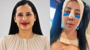 Sandra Cuevas sorprende con su nueva apariencia tras cirugía; redes sociales reaccionan con críticas y memes