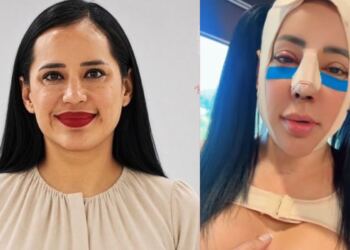 Sandra Cuevas sorprende con su nueva apariencia tras cirugía; redes sociales reaccionan con críticas y memes